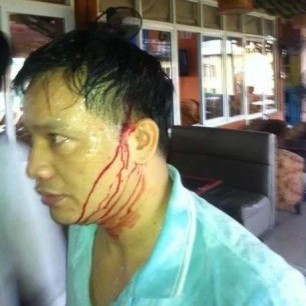 Vietnam Nguyen Van Dai attacked by plainclothes police